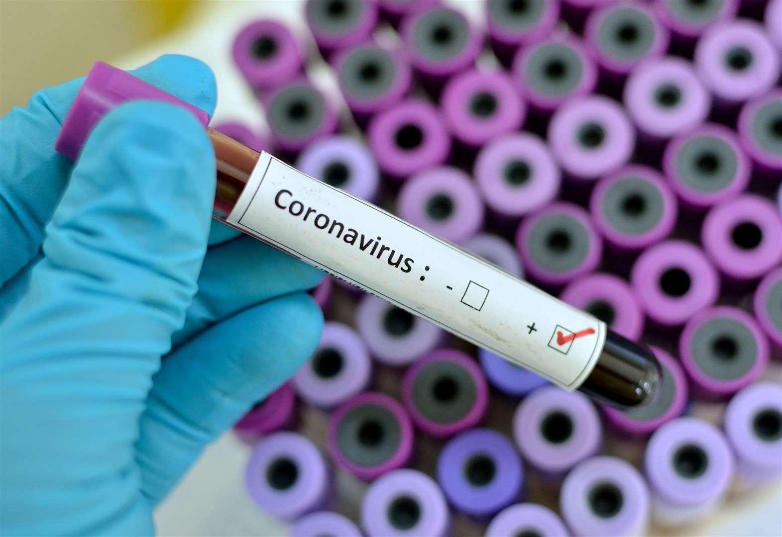 Dois casos positivos de coronavírus são registrados em Valinhos 
