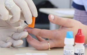 Centro estadual de DST/Aids inicia testes de vacina inédita contra o HIV