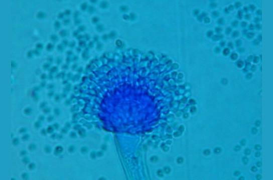 Fungos causam riscos à saúde humana pouco conhecidos 