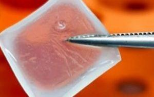 Biocurativo de células-tronco permite o tratamento inteligente de feridas e queimaduras