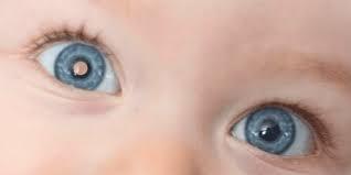 Retinoblastoma: câncer no olho de bebês pode ser detectado em fotos feitas com flash