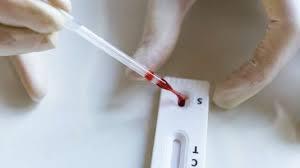 Testes positivos de covid sobem de 8,5% para 23,6% em um mês, aponta levantamento