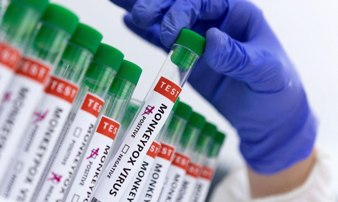 Saúde confirma mais quatro casos de monkeypox em Campinas