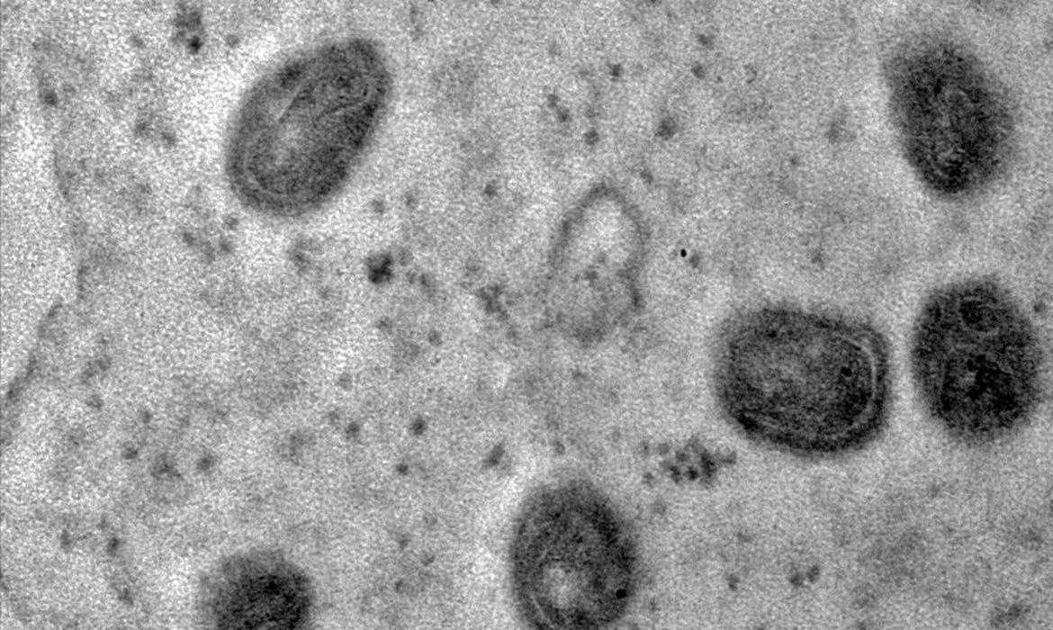 Fiocruz registra imagens de replicação do vírus monkeypox em célula