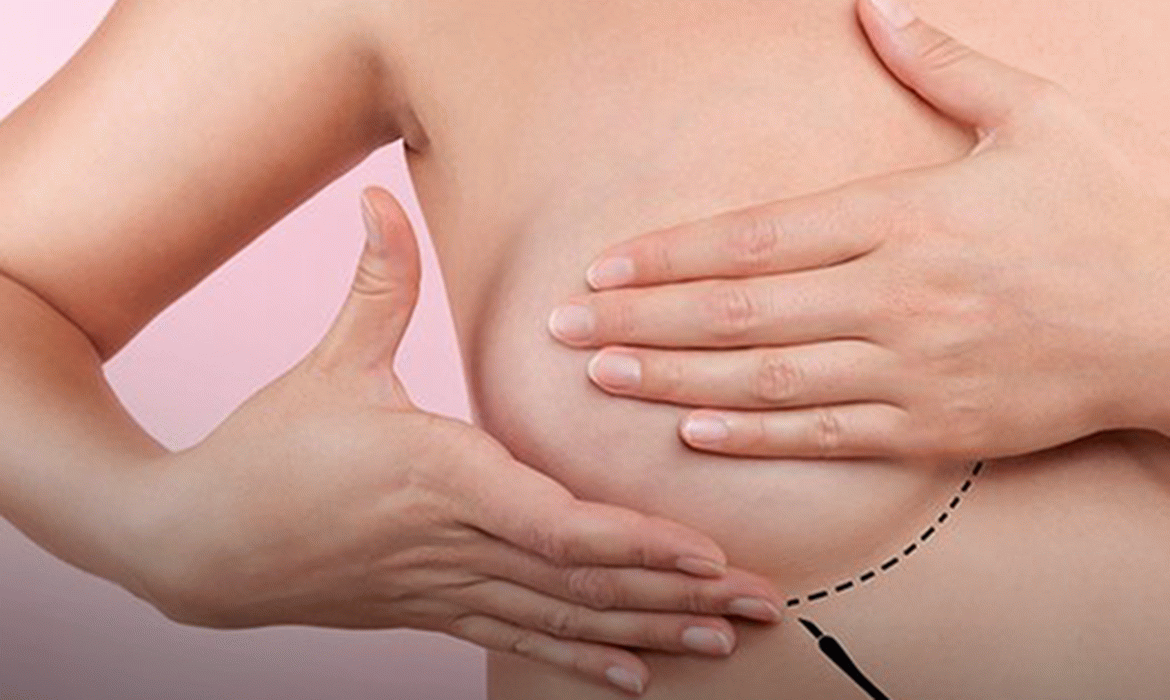 Pesquisadores depositam patente no INPI para tratar câncer de mama