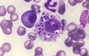 Leishmaniose visceral: estudo de SP desenvolve teste para nova espécie de parasita