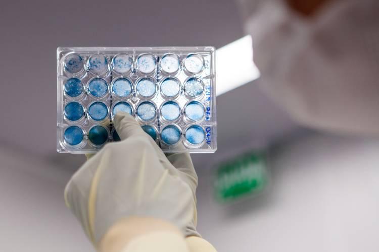 Butantan trabalha em vacina contra Zika para prevenir microcefalia em recém-nascido