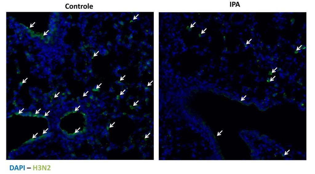 Molécula produzida no intestino pode ter efeito protetor contra gripe, indica estudo