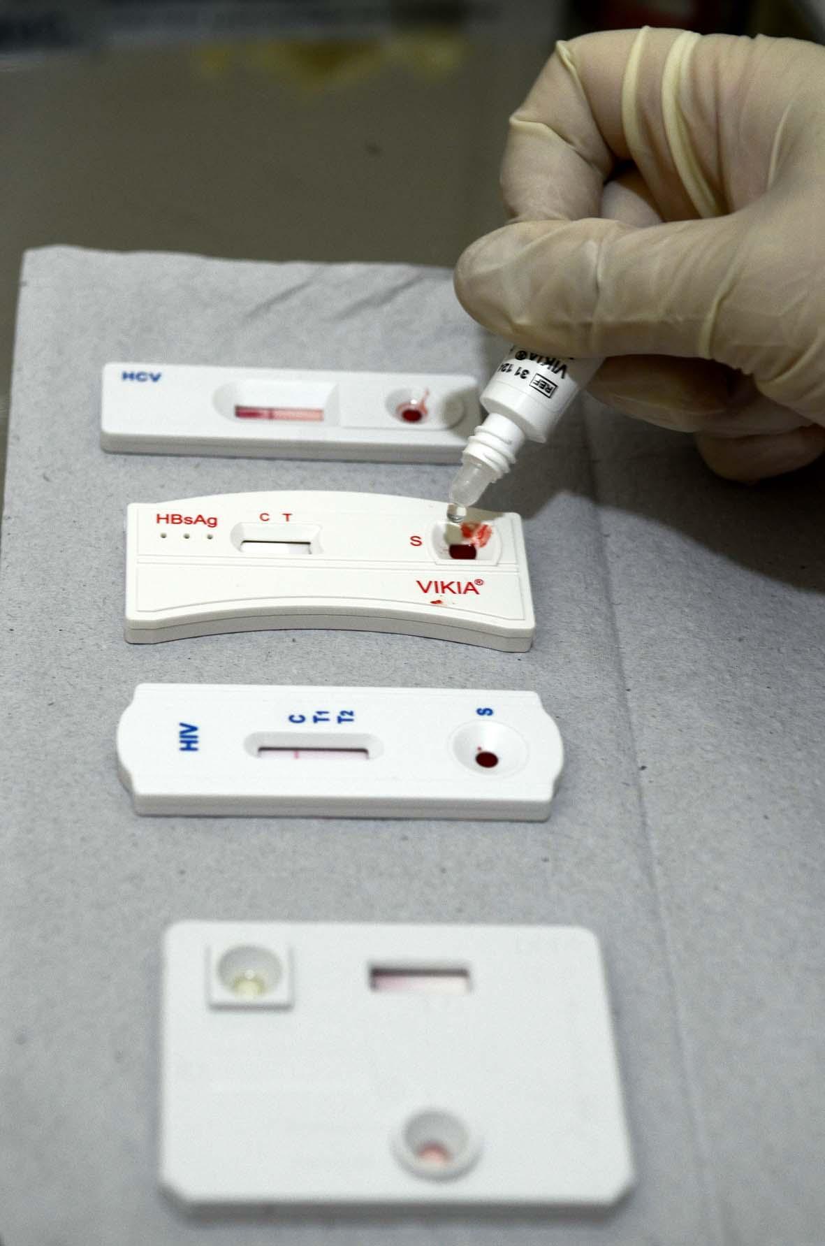 Farmácias poderão realizar testes rápidos de HIV e sífilis