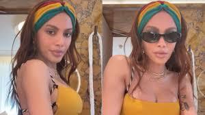 Anitta reaparece após procedimento estético e web comenta nova aparência: 'outra pessoa'