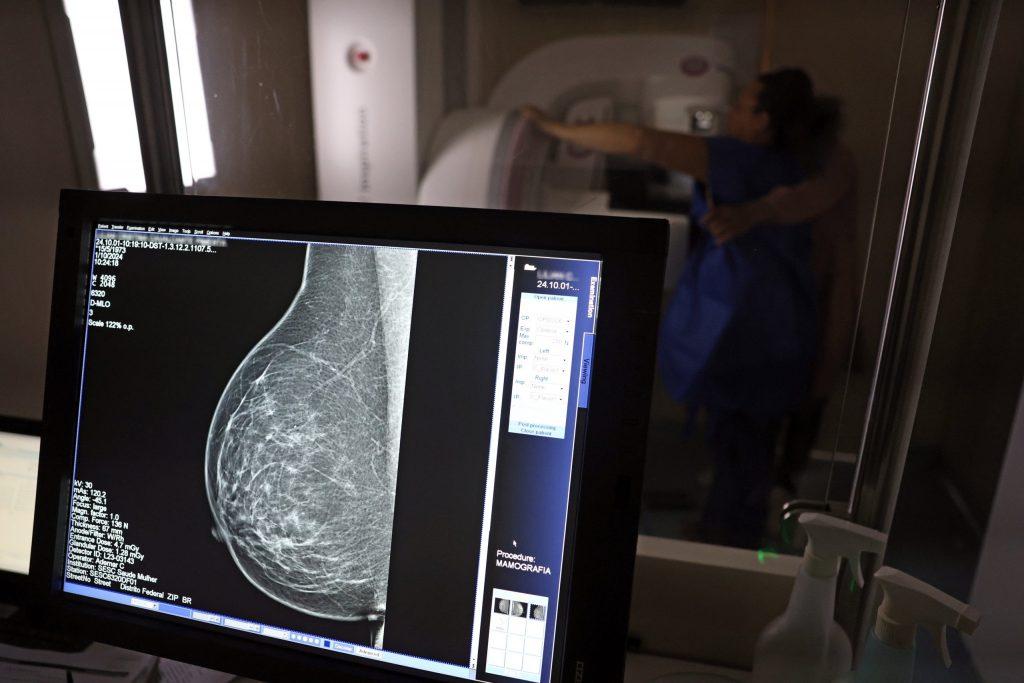 Baixa adesão à mamografia dificulta diagnóstico de câncer de mama; veja hábitos que reduzem fatores de risco