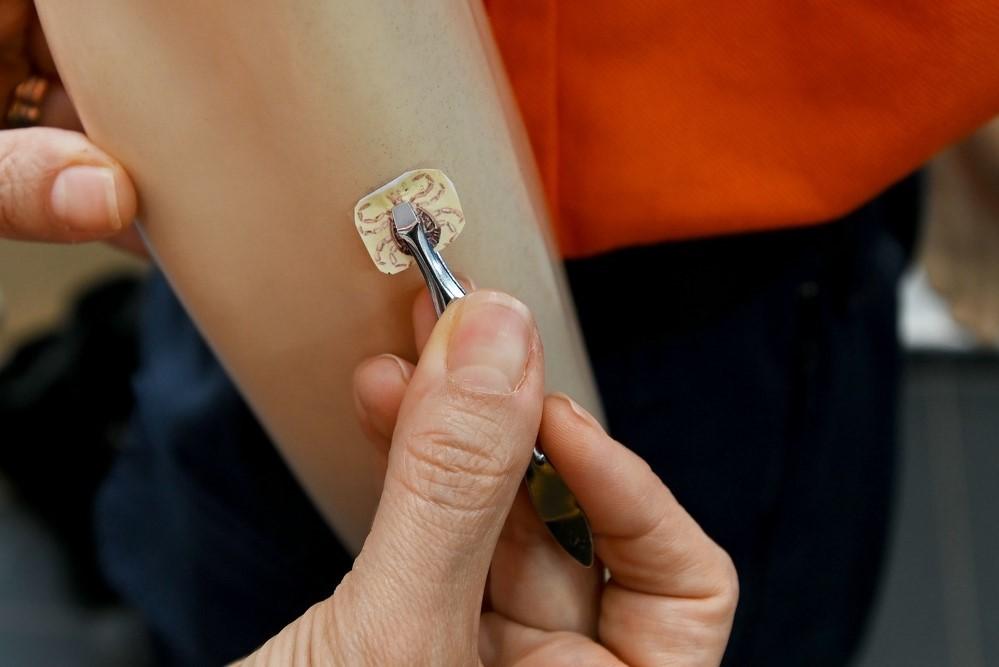 Saúde de Campinas registra duas mortes por febre maculosa e reforça alerta para prevenção
