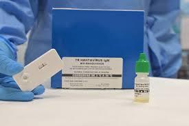 Novo teste faz diagnóstico de hantavirose em 20 minutos