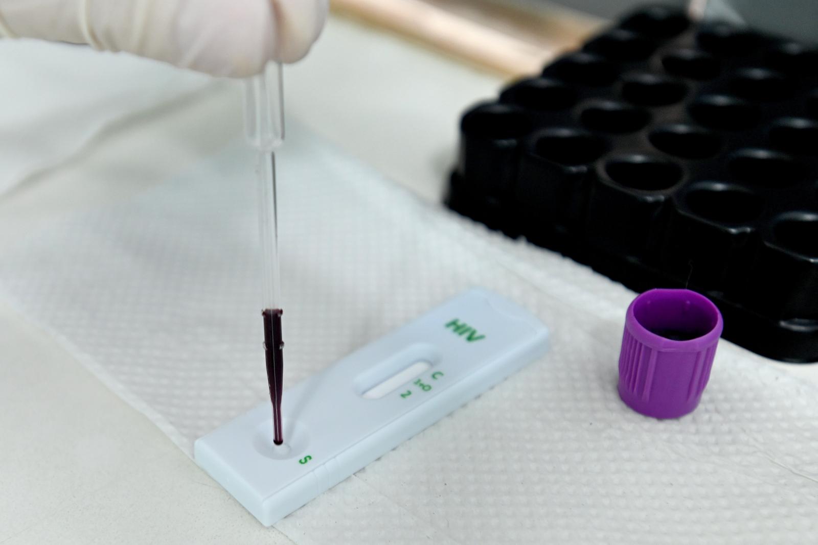 Campinas integra pesquisa da Fiocruz para aceitação de medicamento injetável contra HIV
