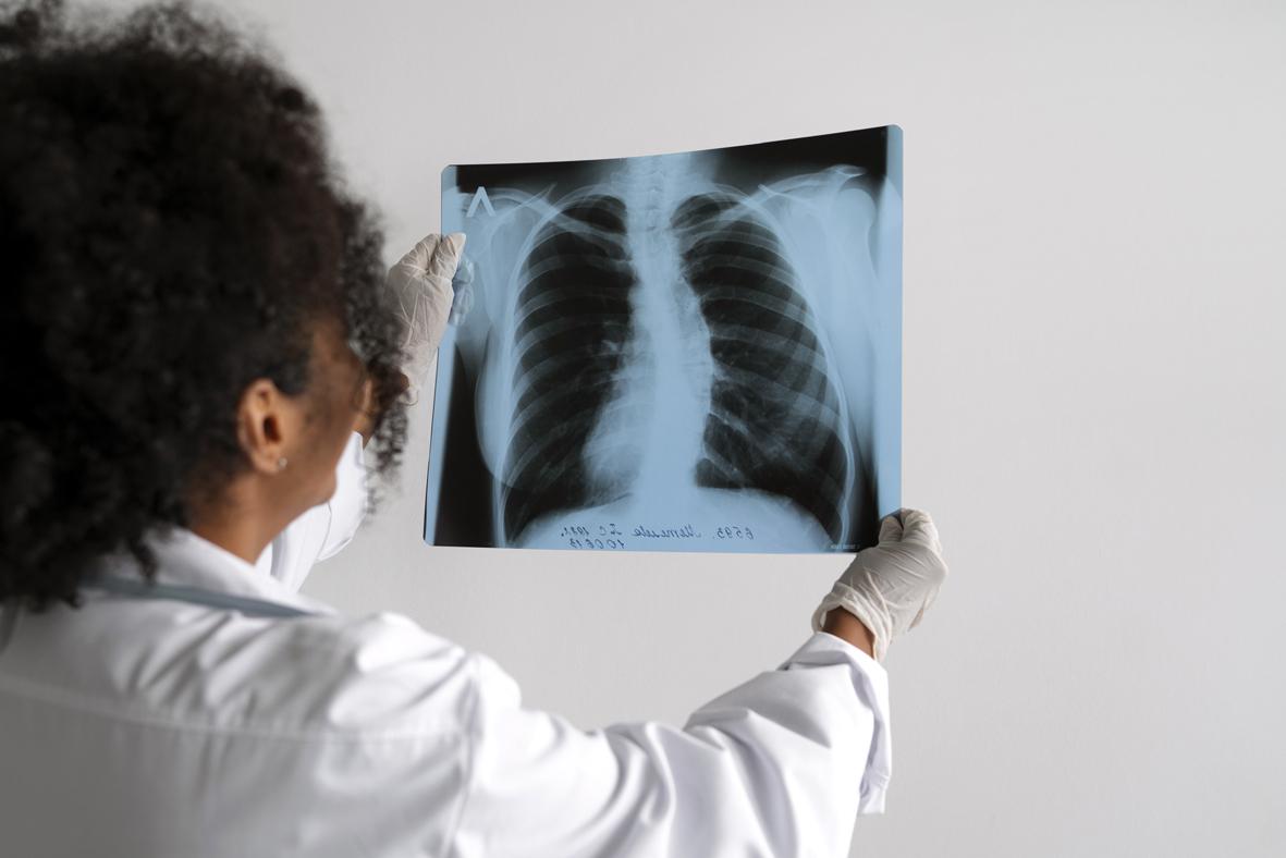 Casos de tuberculose mantêm atenção da Saúde em Itatiba com 7 confirmações já em 2026