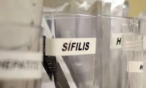 SUS passa a adotar antibiótico para prevenir sífilis e clamídia