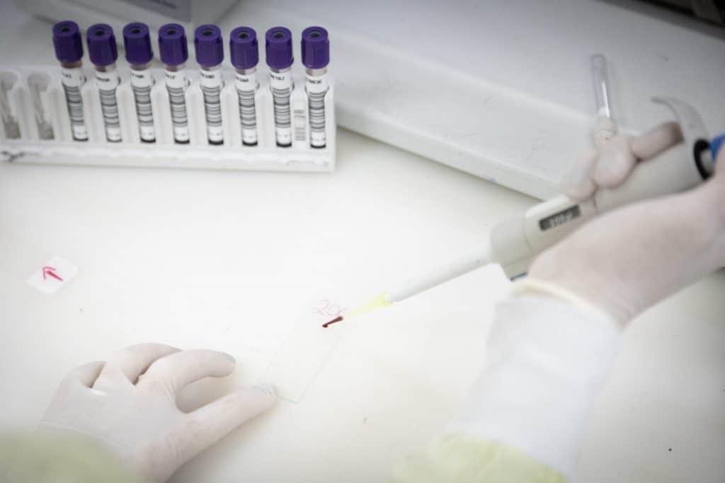 São Paulo investiga caso suspeito de Ebola e mantém vigilância em saúde no estado