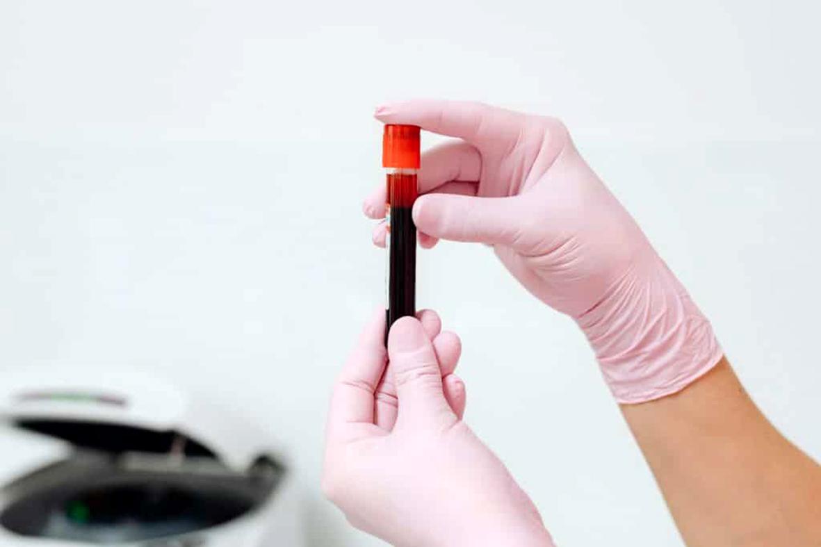 Campanha de doação de sangue do Rotary Club de Itatiba antecede o Dia Mundial do Doador de Sangue