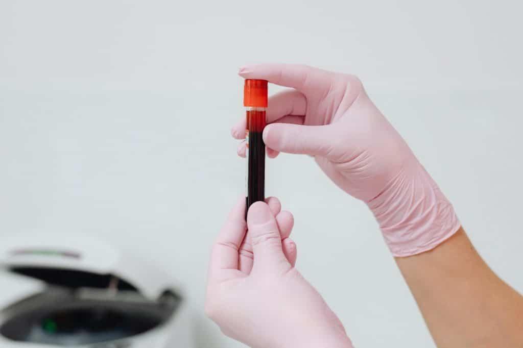 Junho Vermelho reforça importância da doação de sangue para o tratamento de pacientes com leucemia