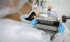 Malária: Anvisa autoriza teste em humanos de vacina 100% brasileira